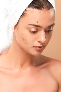 naked girl with pimples on face isolated on beige