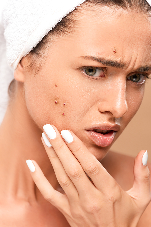 upset woman in towel touching face with acne isolated on beige