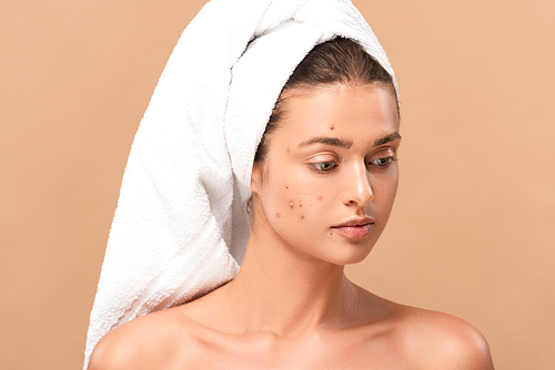 naked girl in towel with acne on face isolated on beige