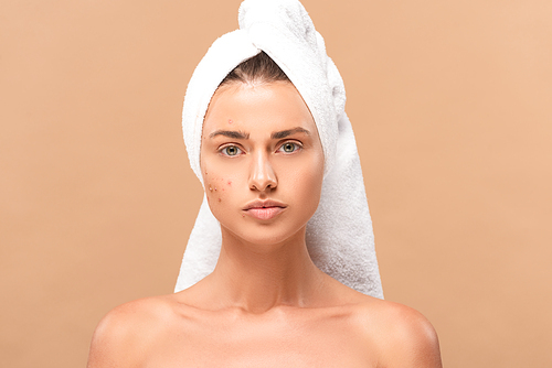 nude girl in towel with acne on face isolated on beige