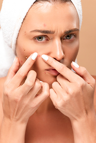 young woman in towel squeezing pimples isolated on beige