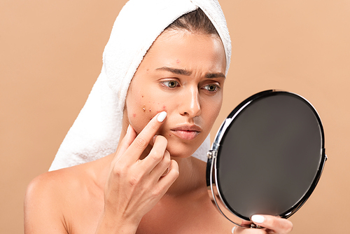 upset nude girl in towel touching acne on face and looking at mirror isolated on beige