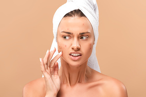 upset nude girl in towel touching acne on face isolated on beige