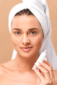 cheerful and naked girl with acne on face holding treatment cream isolated on beige