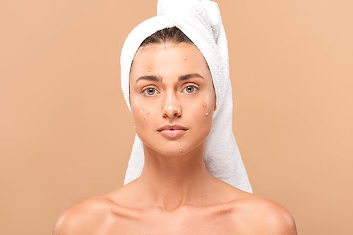 young naked woman with pimples on face  isolated on beige