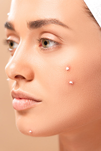 close up of woman with acne on face isolated on beige