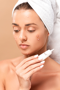 naked girl with acne on face holding tube with treatment cream isolated on beige