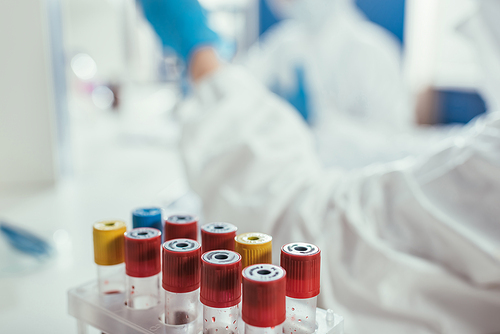 selective focus of test tubes with blood samples near biochemists in lab