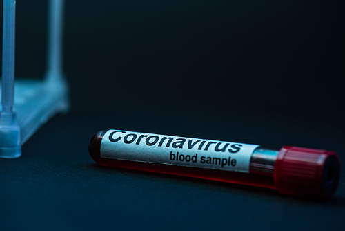 Selective focus of sample tube with coronavirus blood sample on dark