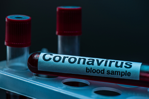 Selective focus of sample tube with coronavirus blood sample lettering on test tube rack on dark