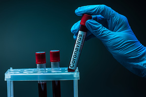 Cropped view of scientist holding tube with coronavirus blood sample lettering near test tube rack on dark background