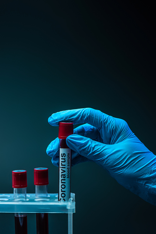 Partial view of scientist holding tube with coronavirus blood sample lettering near test tube rack on dark