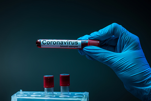 Cropped view of scientist showing test tube with coronavirus blood sample lettering on dark background