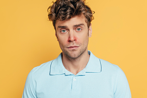 Portrait of sick man with redness on nose isolated on yellow