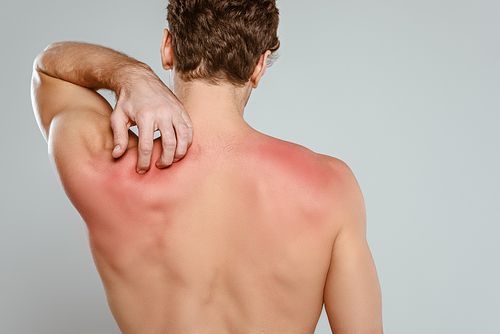 Back view of man scratching skin with allergy isolated on grey