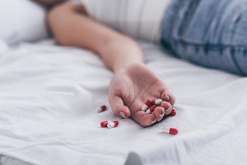 partial view of lifeless woman, committed suicide by overdosing medicines, lying on bed near scattered pills
