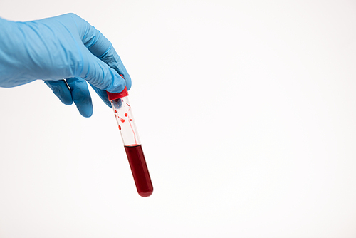 Cropped view of doctor in latex glove holding test tube with blood sample isolated on white