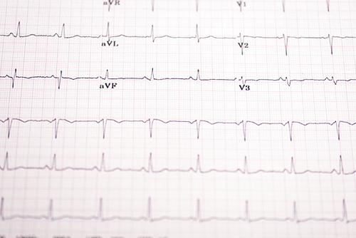 Selective focus of electrocardiogram on paper