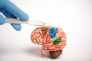 Cropped view of surgeon holding scalpel near brain model on white background, alzheimer disease concept
