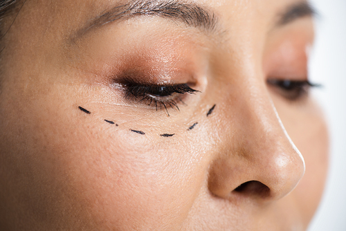 close up of asian woman with plastic surgery correction mark on face isolated on grey