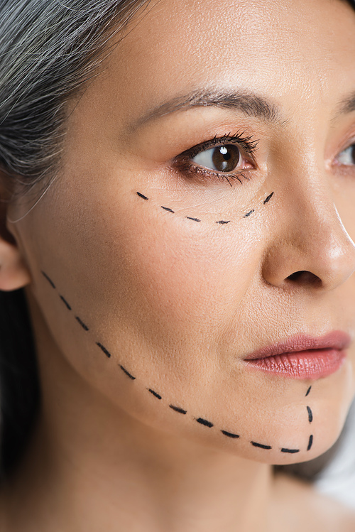 beautiful asian woman with plastic surgery correction mark on face isolated on grey