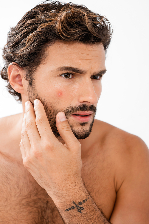 Worried man with acne on cheek isolated on grey