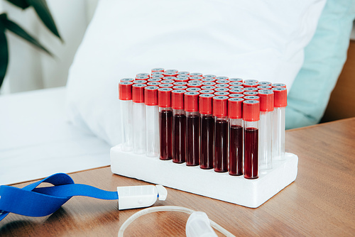 tourniquet and test tubes with blood near bed in clinic