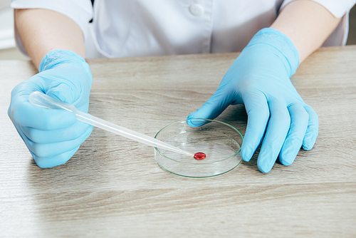 cropped view of doctor in latex gloves holding pipette with blood sample