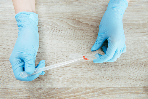 cropped view of doctor in latex gloves holding pipette and misroscope slide with blood sample