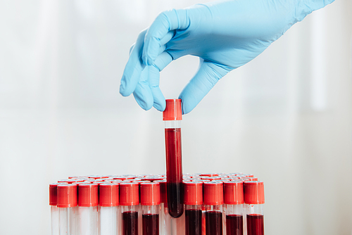 cropped view of doctor in latex glove holding test tube with blood