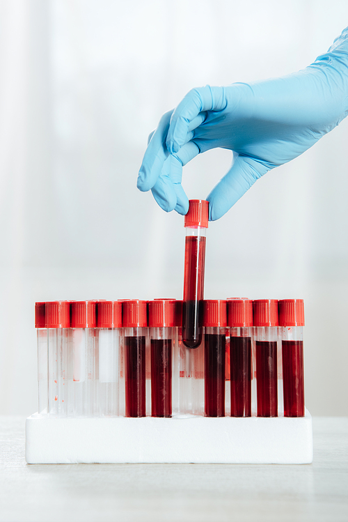 cropped view of doctor in latex glove holding test tube with blood