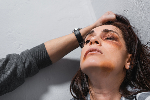 Abusive husband holding hair of wife with bruises on face