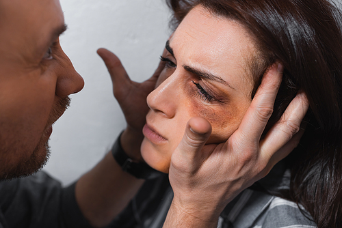 Aggressive man touching face of wife with bruises
