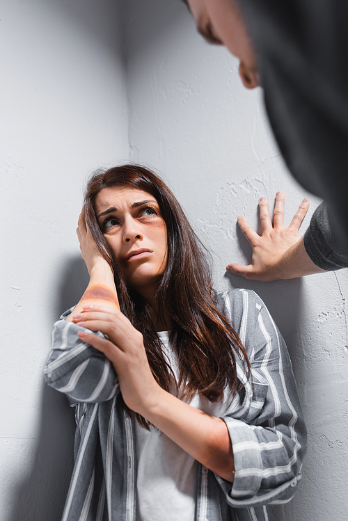 Frightened woman with bruises on face and hand near head looking at husband on blurred foreground