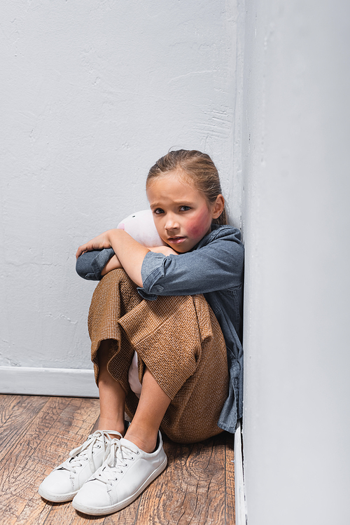 Scared child with bruise on face hugging soft toy on floor