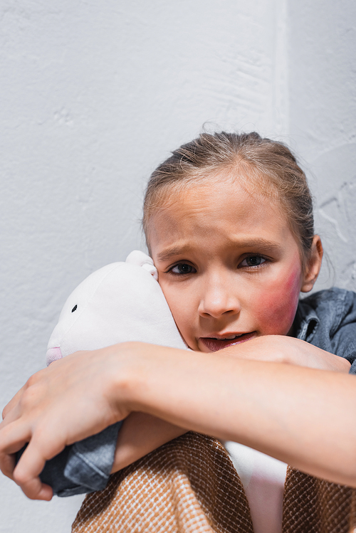 Frightened victim of domestic violence with bruise on cheek hugging soft toy