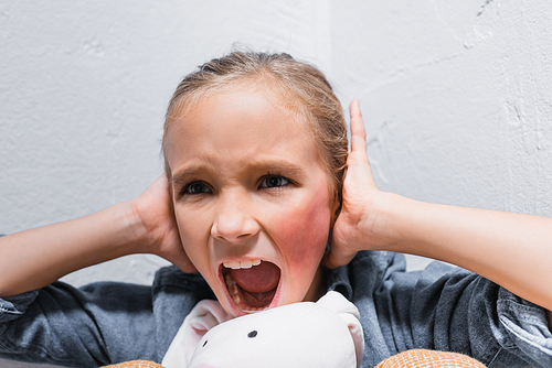 Screaming girl with bruise on face covering ears with hands near soft toy