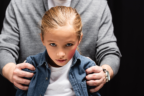 Child with hematoma on face  near abusive father on blurred background isolated on black