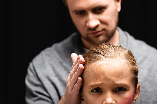 Abusive father on blurred background touching head of daughter with hematoma on cheek isolated on black