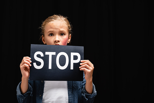 Child with bruise on cheek holding card with stop lettering isolated on black