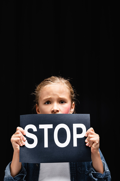 Frightened kid with hematoma on cheek holding card with stop lettering isolated on black