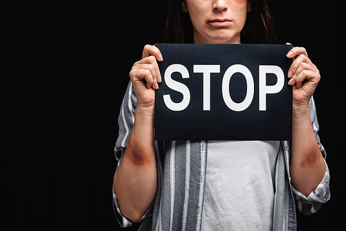 Cropped view of woman with bruises on hands holding card with stop lettering isolated on black