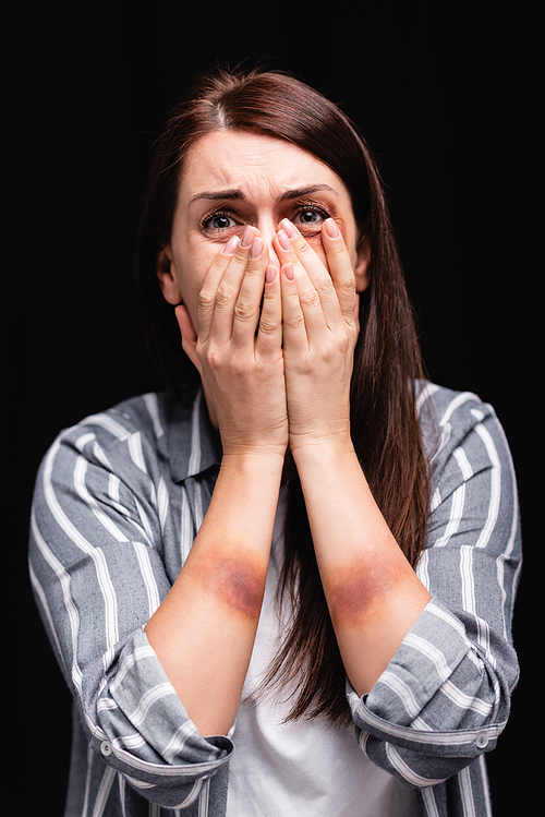 Depressed woman with bruises on hands covering mouth isolated on black
