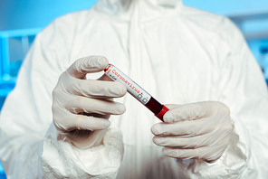 selective focus of scientist in latex gloves holding sample with coronavirus lettering
