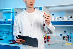 cropped view of scientist holding test tube with coronavirus lettering and clipboard