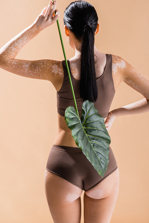 back view of young beautiful woman with vitiligo posing with green leaf isolated on beige
