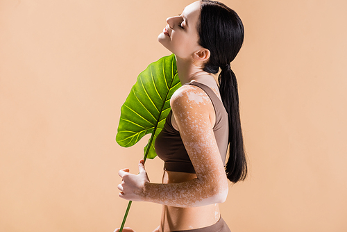 side view of smiling young beautiful woman with vitiligo posing with green leaf isolated on beige