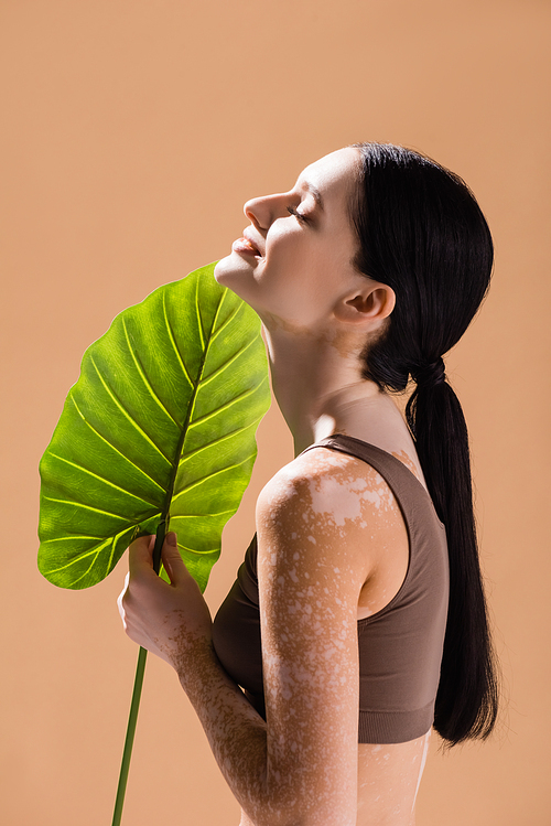 side view of smiling young beautiful woman with vitiligo posing with green leaf isolated on beige