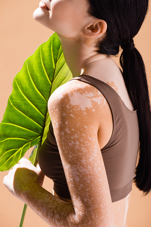 partial view of young beautiful woman with vitiligo posing with green leaf isolated on beige
