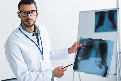 young doctor in eyeglasses pointing at lungs x-ray while 